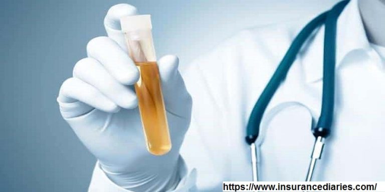 What Is A Life Insurance Urine Test?